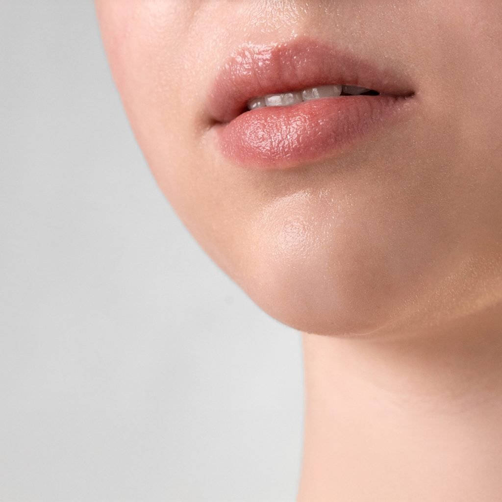 Ácido hialurónico labios