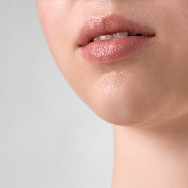 Ácido hialurónico labios